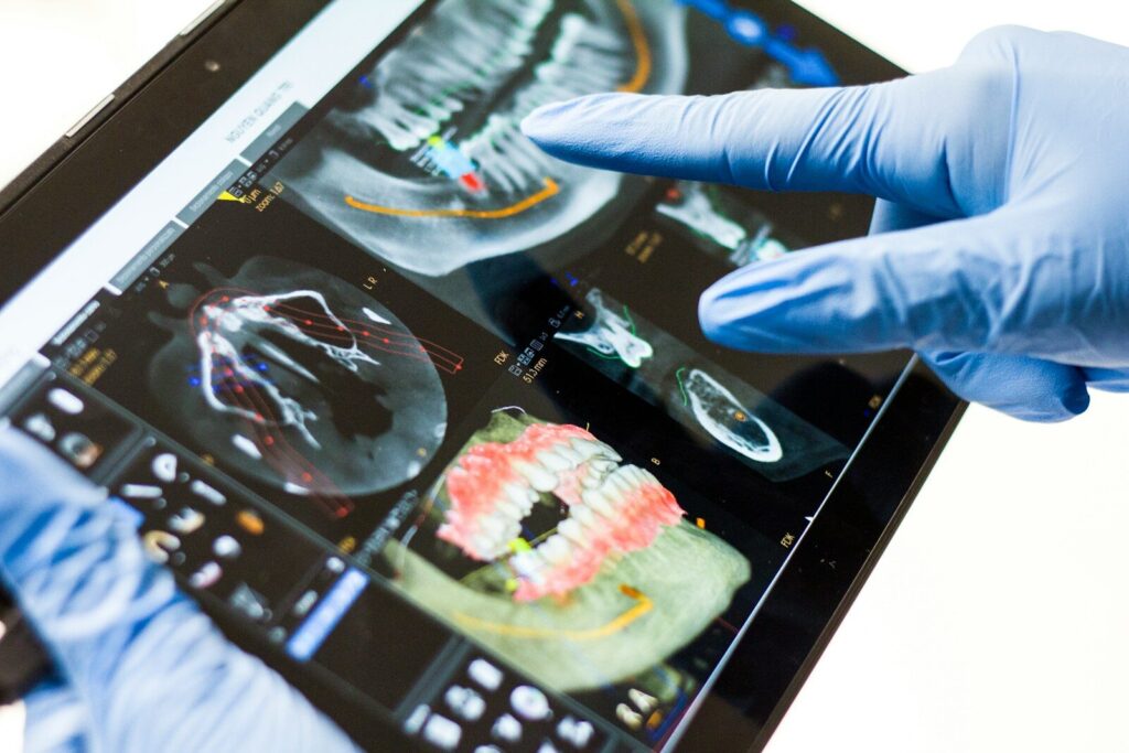 Moderne Zahnarztpraxis - Was Sie über Implantate und zahnmedizinische Versorgung wissen sollten